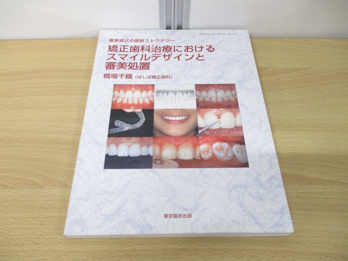 矯正歯科治療におけるスマイルデザインと審美処置 | 削らない審美治療