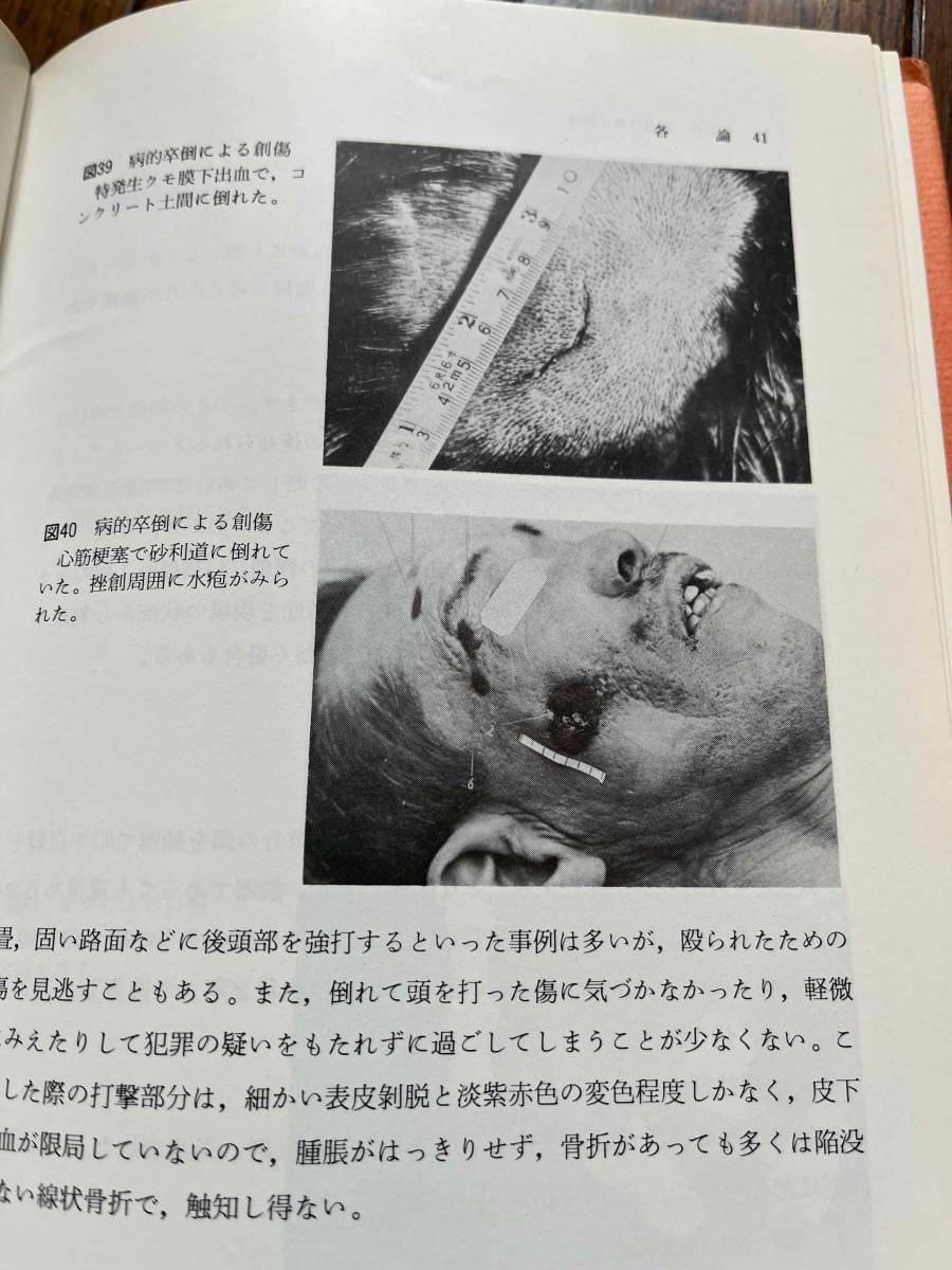 閲覧注意 最新 捜査法医学 内藤道興著 昭和58年2刷 警察捜査 刑事事件 犯罪 死体 変死 殺人事件 自殺 印刷物 売買されたオークション情報 Yahooの商品情報をアーカイブ公開 オークファン Aucfan Com