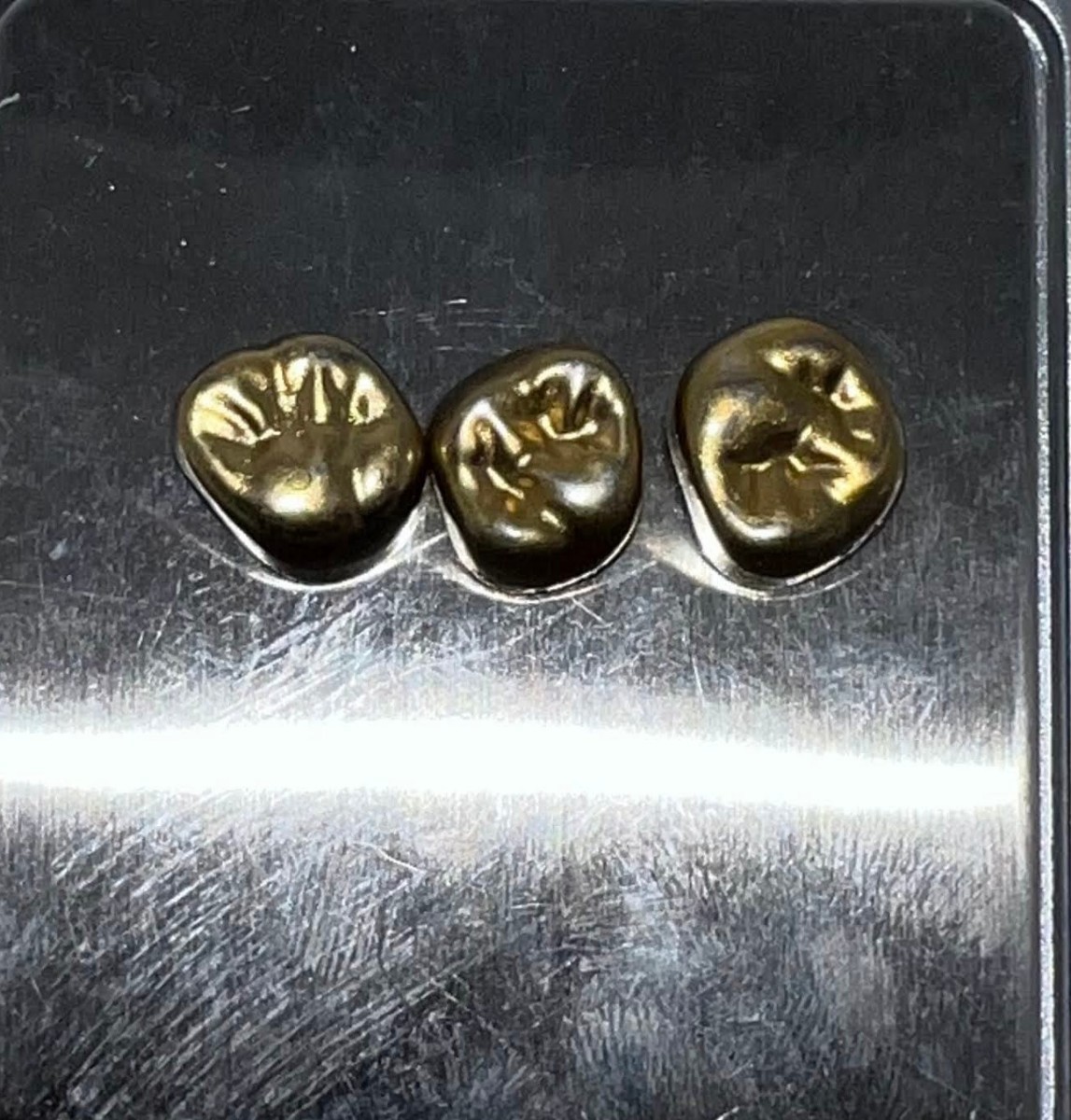 銀歯 除去冠 金パラ 撤去冠 歯科 歯科金属 撤去冠18g ☆1円 約2.09g⁄金