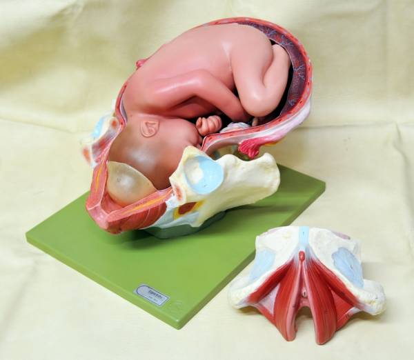 人体模型 婦人科 胎児 女性器 分娩模型 MS45/1ドイツsomso製(雑貨