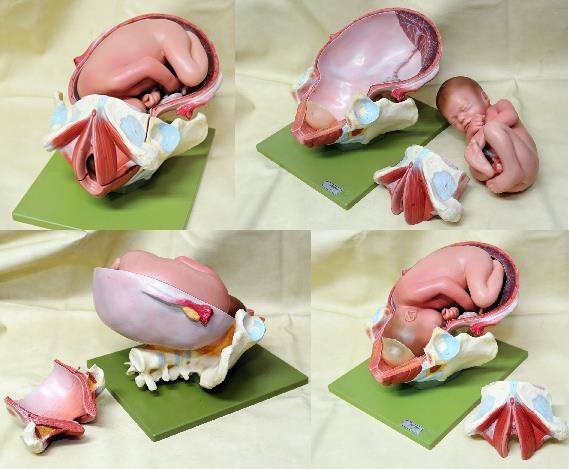 人体模型 婦人科 胎児 女性器 分娩模型 MS45/1ドイツsomso製(雑貨
