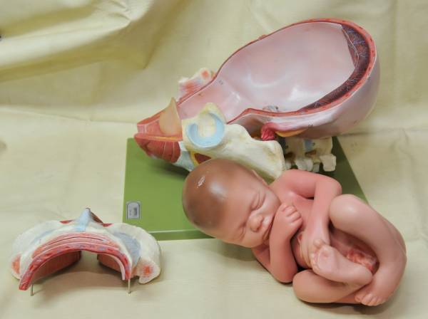 人体模型 婦人科 胎児 女性器 分娩模型 MS45/1ドイツsomso製(雑貨