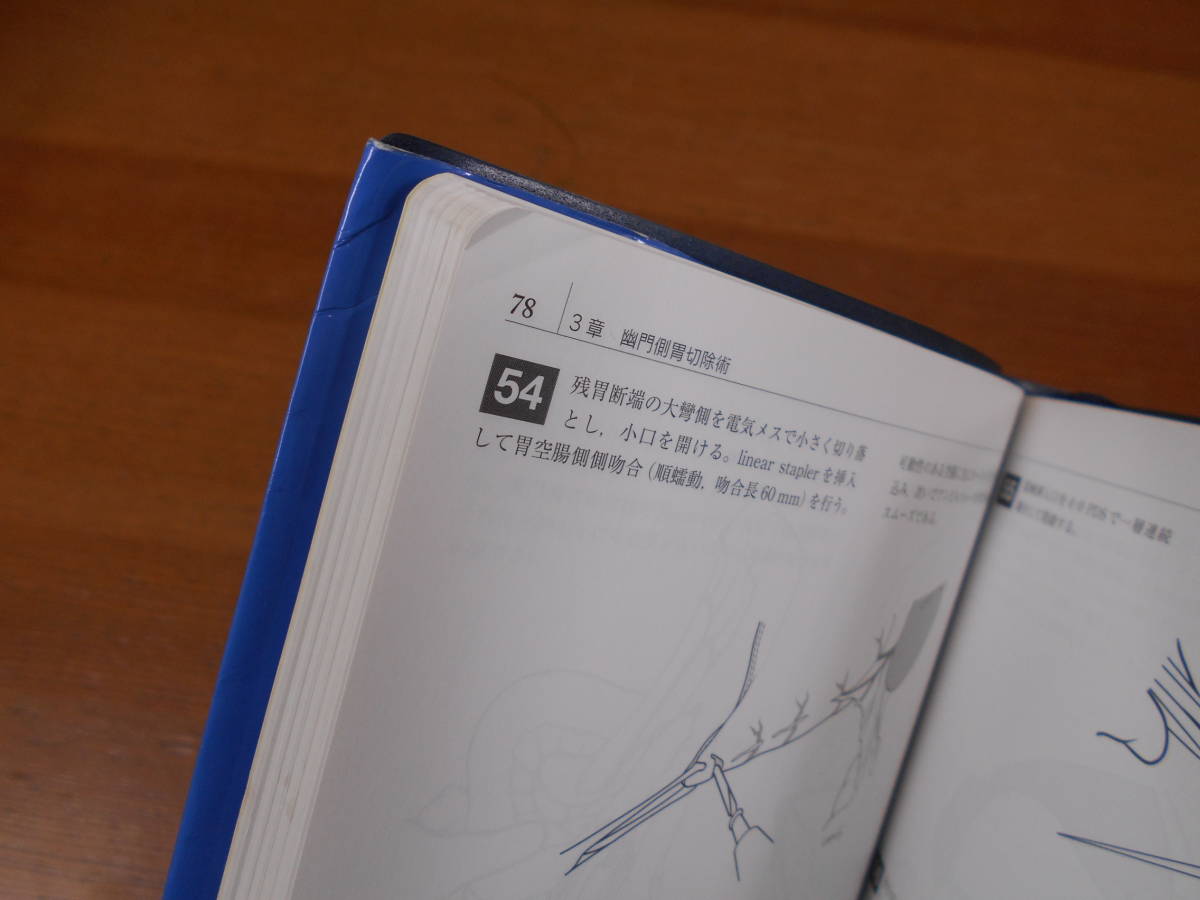 イラストレイテッド外科手術 | 第3版 医学書院 膜の解剖からみた術式の