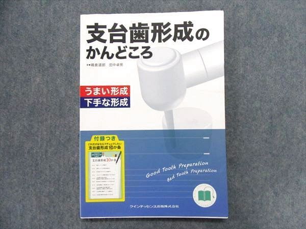 イラストで見る筒井昌秀の臨床テクニック 包括歯科臨床 イラストで見る