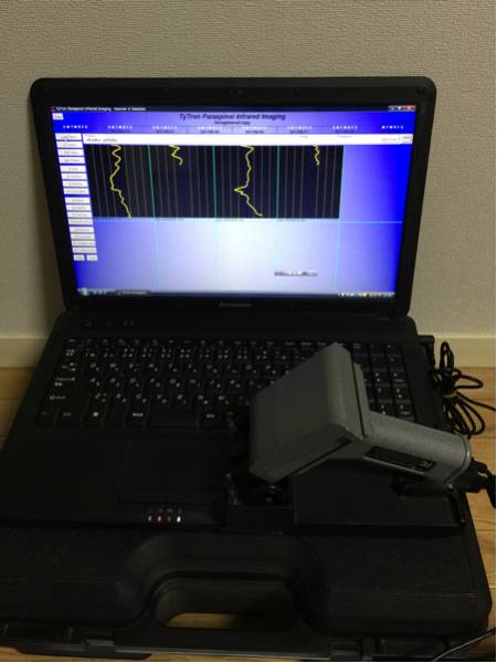 タイトロン Tytron C-3000N スキャナー C5000 カイロプラクティック 