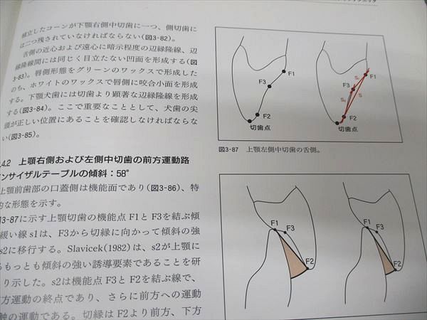 クインテッセンス出版 臨床家のための歯科補綴学 ビジュアル 臨床補綴