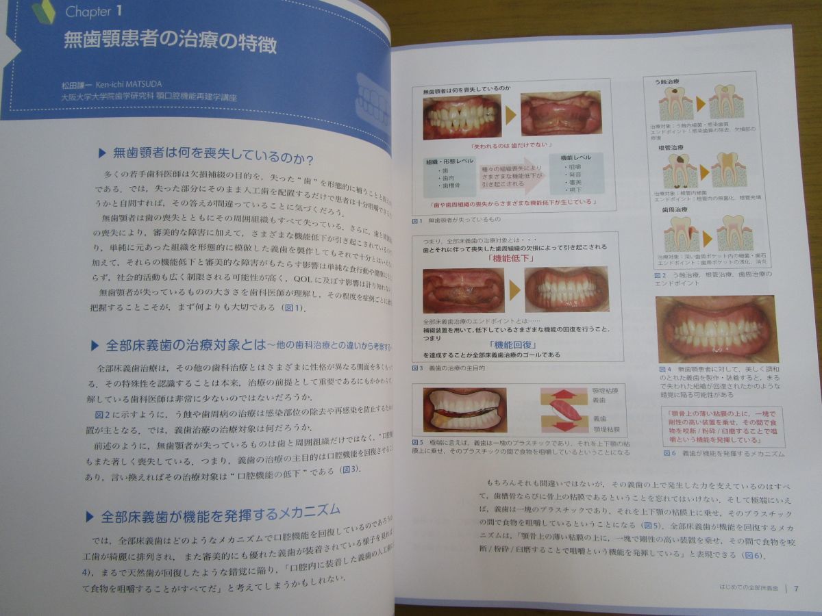 歯界展望 別冊 | 松田 謙一, はじめての全部床義歯 はじめての部分床