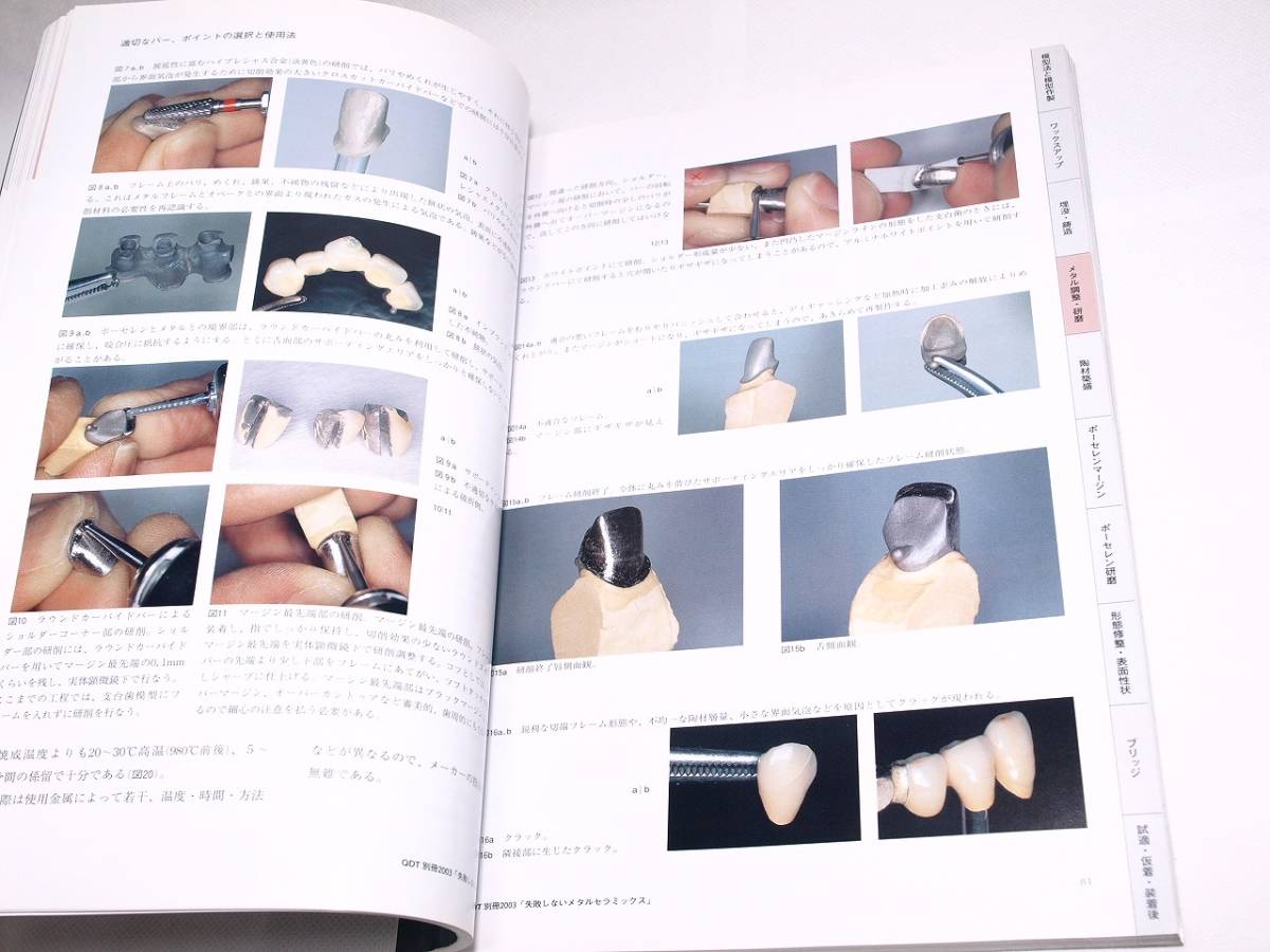 QDT 別冊 失敗しないメタルセラミックス - クインテッセンス出版 基本