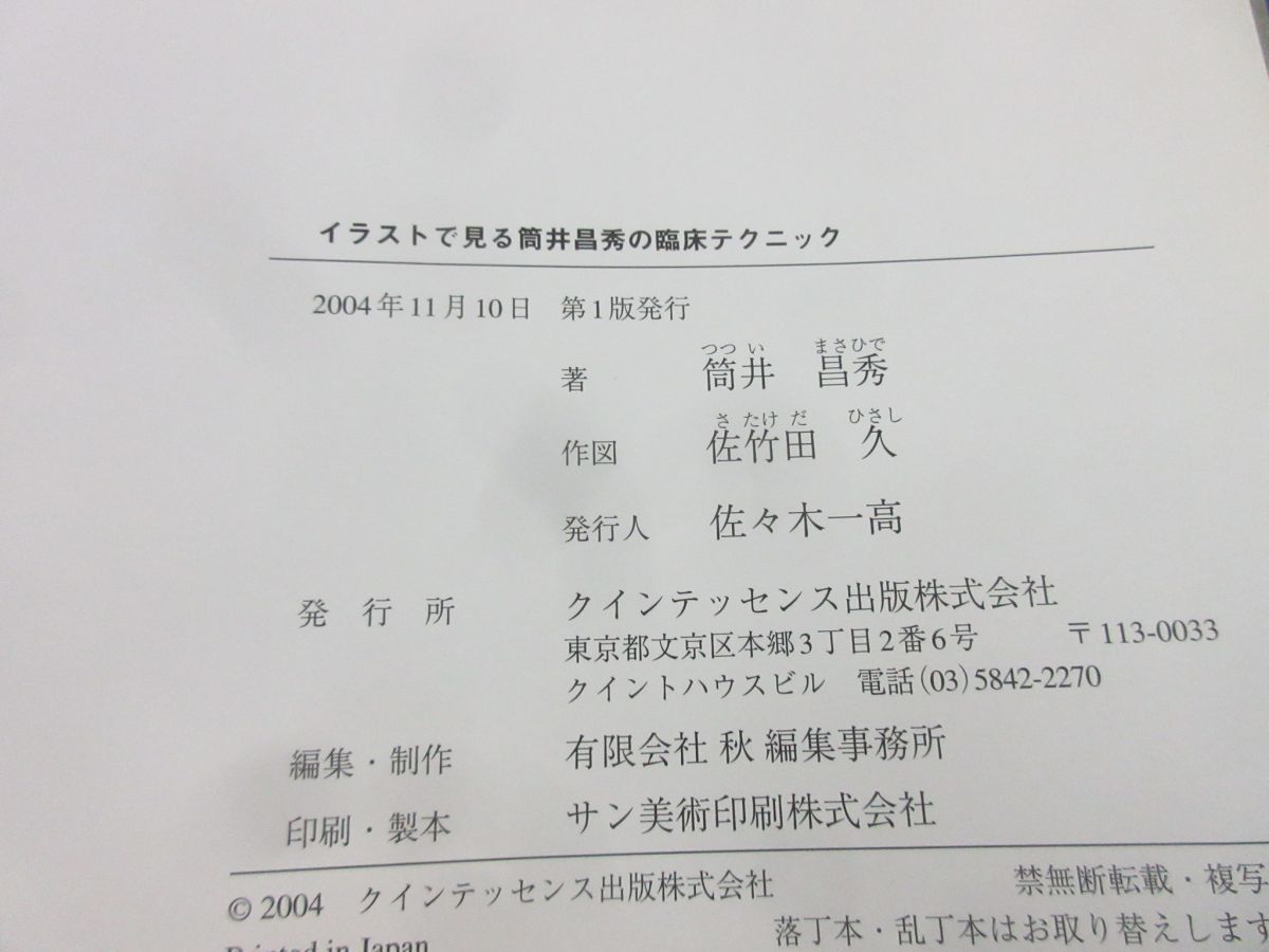 イラストで見る筒井昌秀の臨床テクニック 久 | 筒井 本 |本 佐竹田