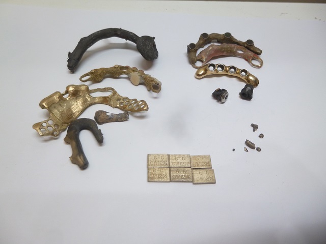 〓〓歯科金属スクラップ 焼成屑 撤去冠 除去冠 湯だまり 白金 鋳造屑  