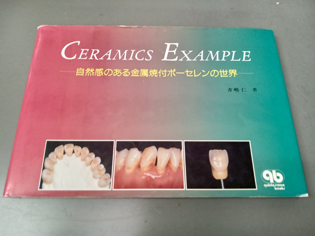 CERAMICS EXAMPLE 自然感のある金属焼付ポーセレンの世界 青嶋仁著