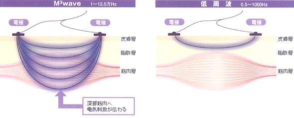31万ベルフォーマ新品パッド付き2018年emsダイエット テクノ