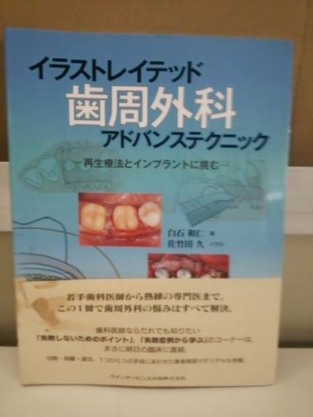 品質保証，高品質 イラストレイテッド 歯周外科アドバンステクニック