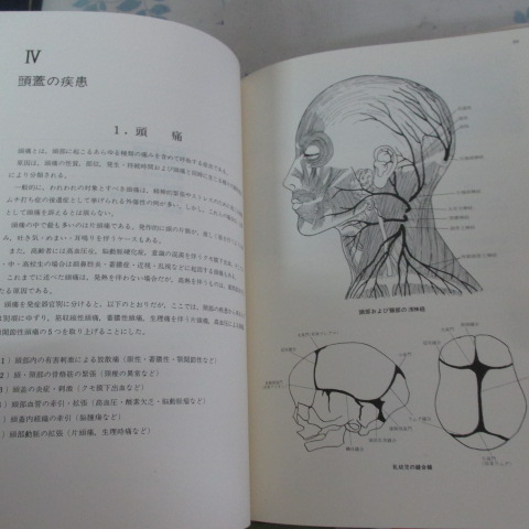 写真イラストで見る症状・病気別 脊椎動可法 1・2・3 _a 変形性脊椎症