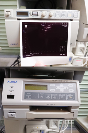 SSD3500SV アロカ 超音波診断装置 ★中古品★動作OK★動物病院様にも お引取歓迎