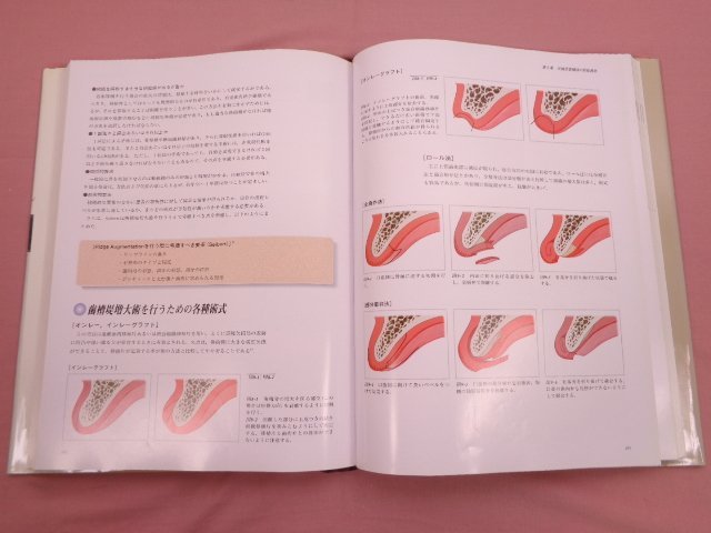 コンセプトをもった予知性の高い歯周外科処置 歯科専門書 コンセプトを