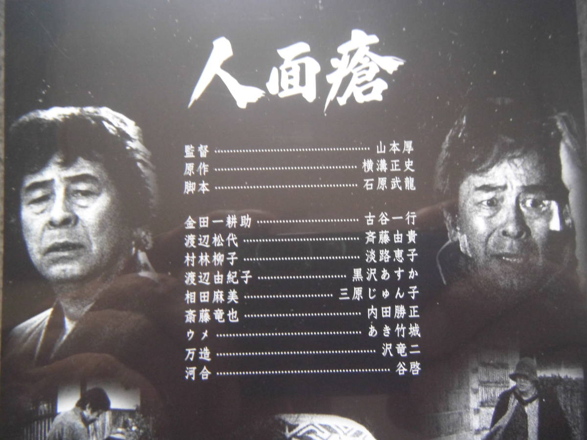 DVD 横溝正史＆金田一耕助シリーズ 通巻46号 人面瘡 古谷一行 