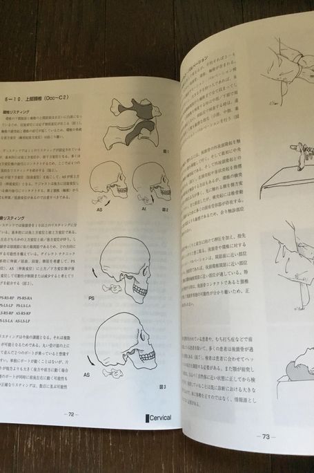 ダイレクト テクニック　パート2 カイロプラクティック　/　オステ　筋膜　整体　矯正　_7