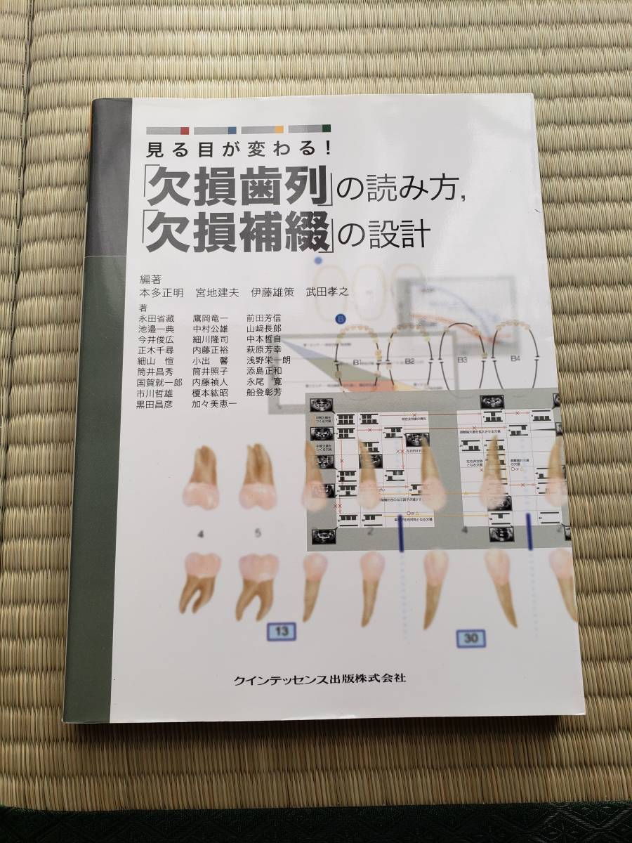 クインテッセンス出版 「欠損歯列」の読み方，「欠損補綴」の設計 本多
