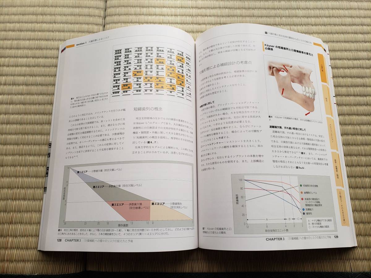 クインテッセンス出版 「欠損歯列」の読み方，「欠損補綴」の設計 本多