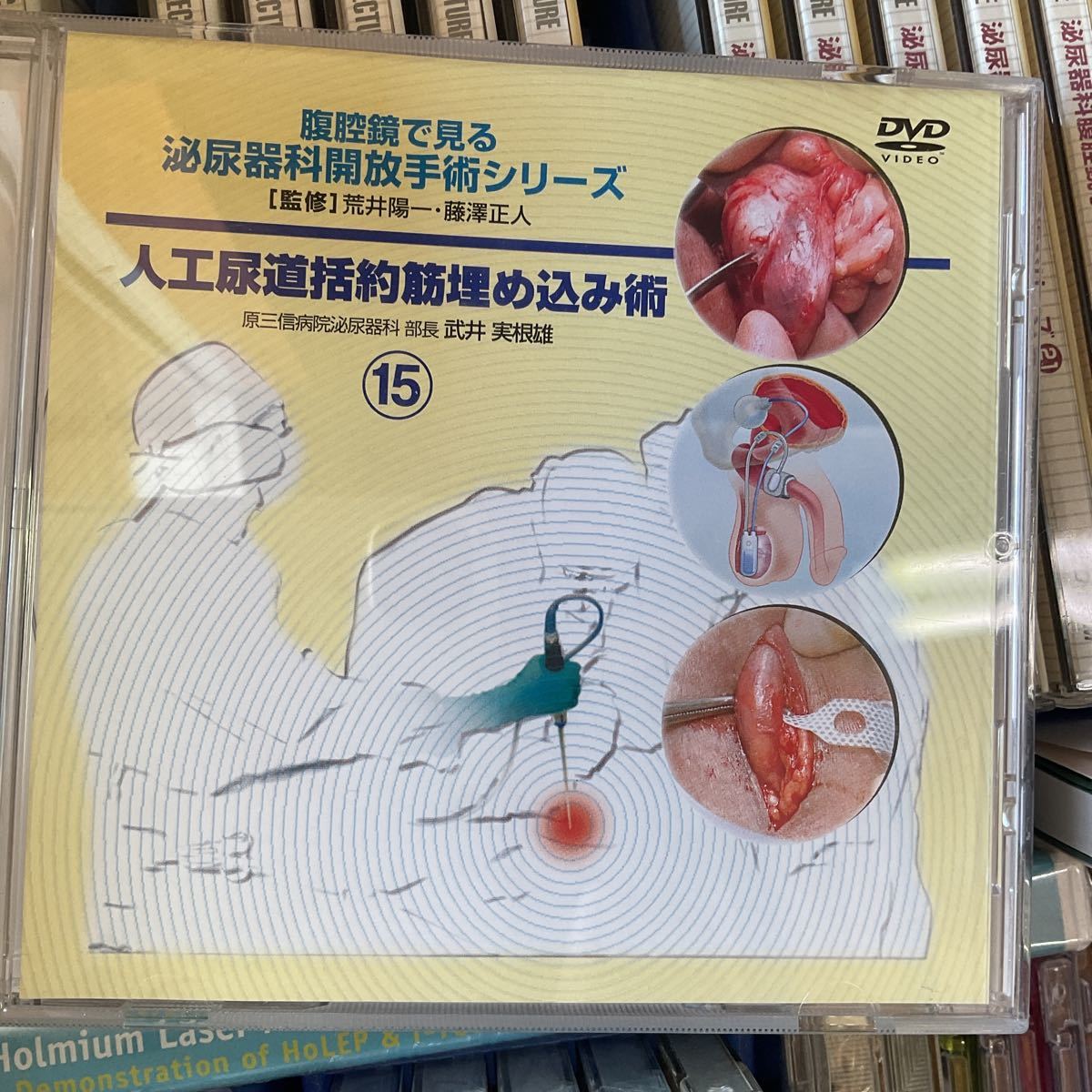 DVD泌尿器科腹腔鏡手術シリーズ 寺地敏郎の入札履歴 - 入札者の順位