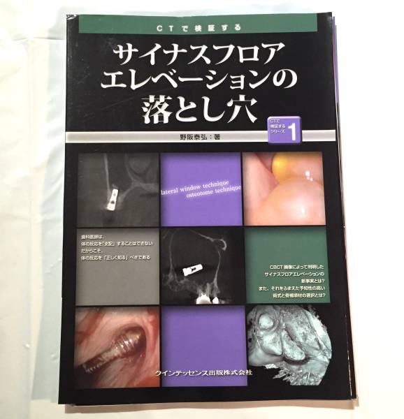 【中古裁断済】サイナスフロアエレベーションの落とし穴