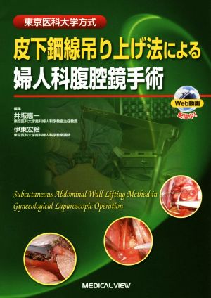 子宮筋腫note 専門医に聞く子宮筋腫 子宮筋腫の低侵襲治療1 腹腔鏡手術
