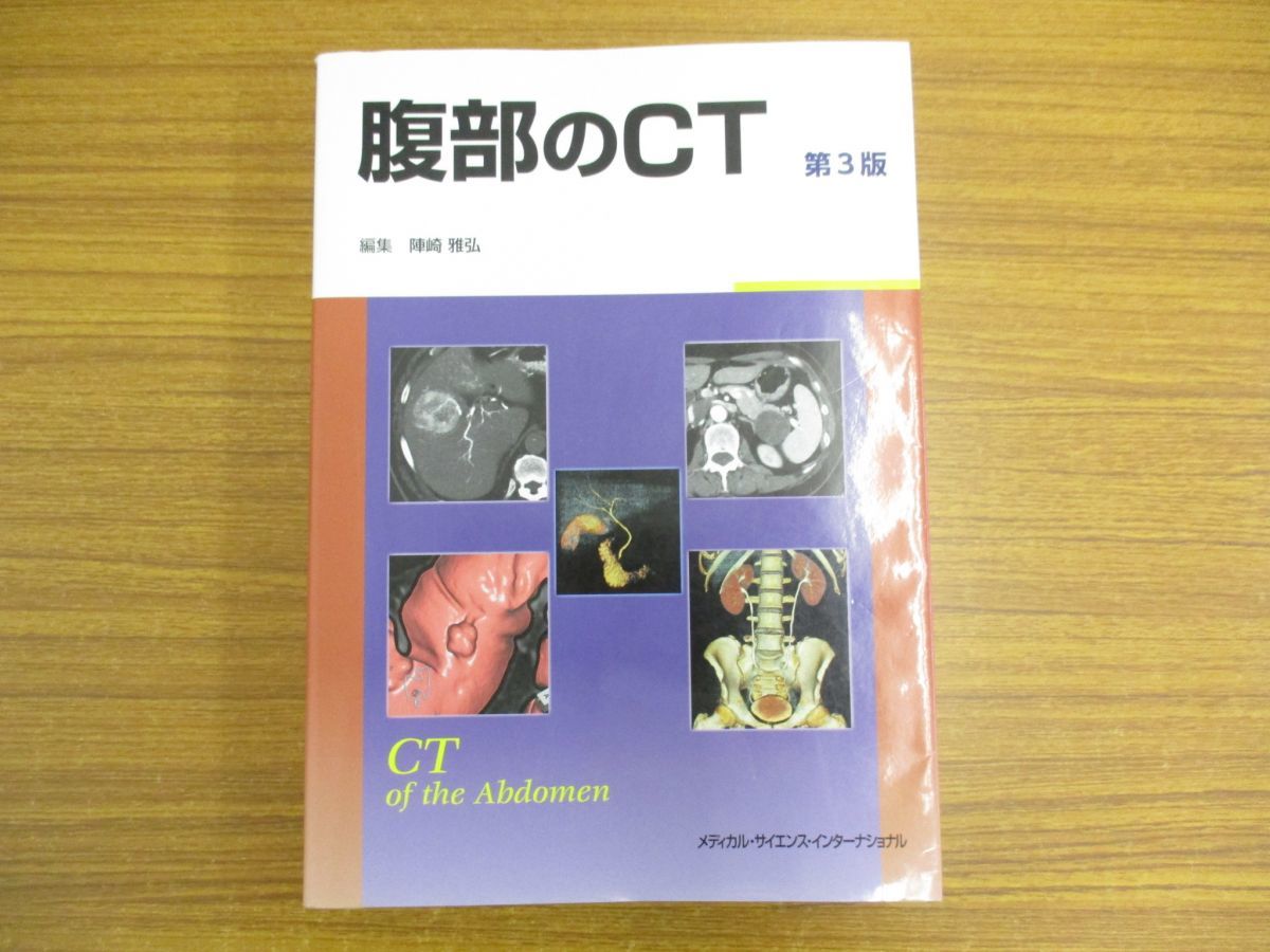 △01)腹部のCT 第3版/陣崎雅弘/メディカル・サイエンス