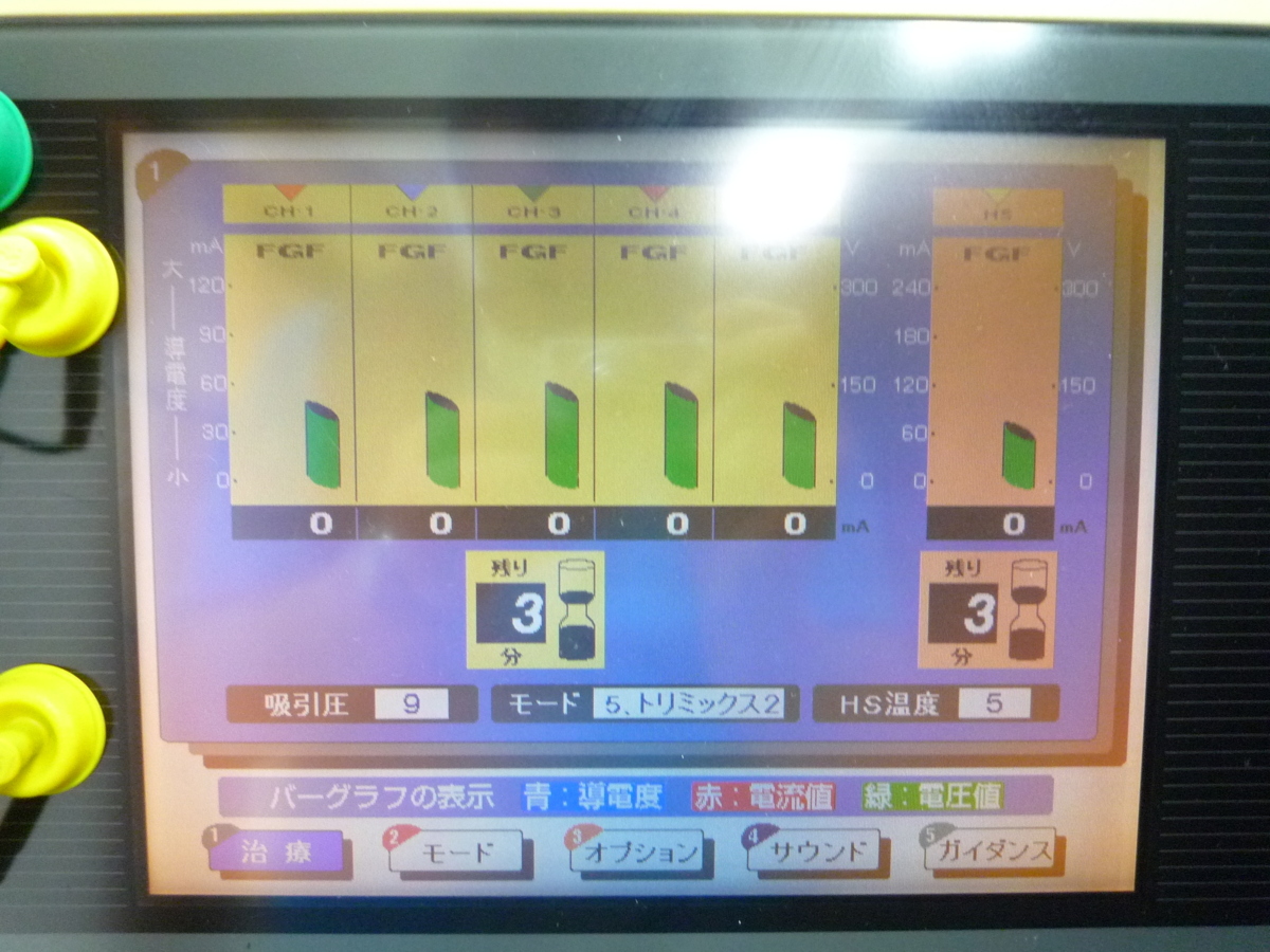 日本メディックス トリミックス リノス TM-5501 低周波治療器 SSP療法