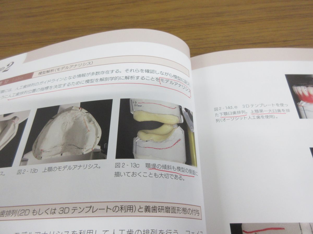 下顎吸着義歯BPSパーフェクトマニュアル 吸着とは外れないことなり 2本セット 下顎吸着義歯BPSパーフェクトマニュアル 吸着とは外れないことなり 2本