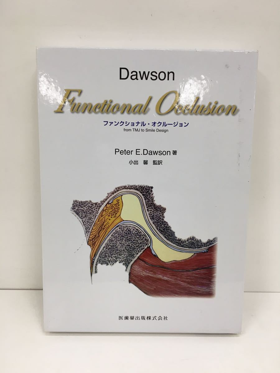 Dawson Occlusionファンクショナル・オクルージョン Functional