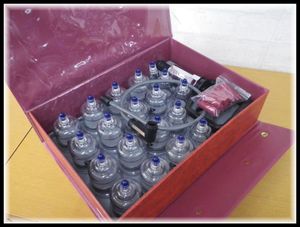 吸い玉の値段と価格推移は 113件の売買情報を集計した吸い玉の価格や価値の推移データを公開