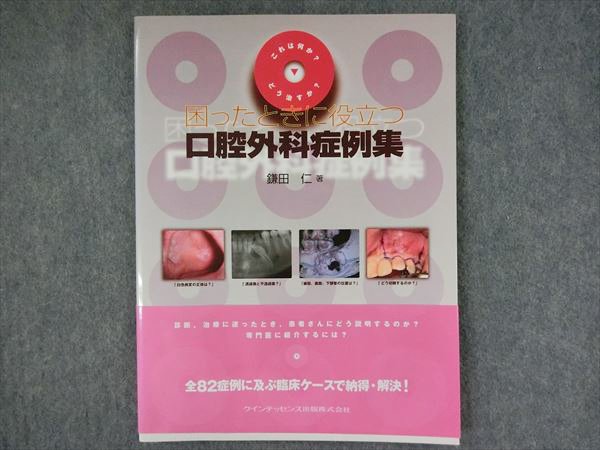 MTM チェアーサイドマニュアル 百瀬保 ワイヤーベンディング 歯科矯正
