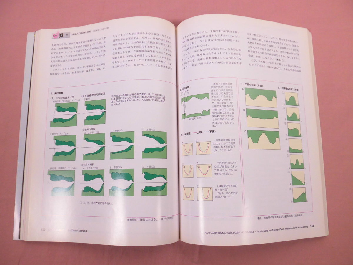 『 月刊 歯科技工 別冊 目でみる人工歯排列＆歯肉形成 』 医歯薬出版株式会社
