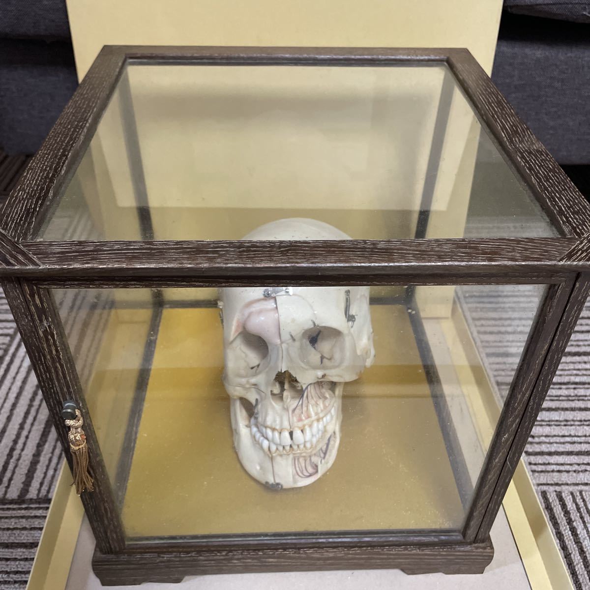  頭蓋骨 歯科教材 標本 医学 医療 医学 スカルヘッド デッサン(医学一般)｜売買されたオークション情報、yahooの商品情報をアーカイブ公開 - オークファン 医学一般