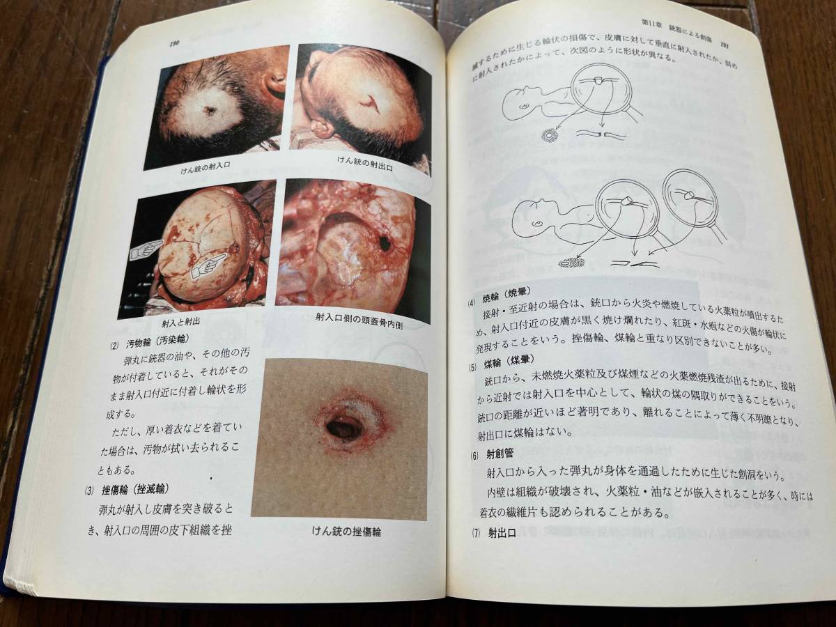 閲覧注意 部内用 ビジュアル 記載例 新訂 検視と法医学 神奈川県警察本部刑事部検視研究会 平成7年 死体 変死 殺人事件 自殺 医学一般 売買されたオークション情報 Yahooの商品情報をアーカイブ公開 オークファン Aucfan Com
