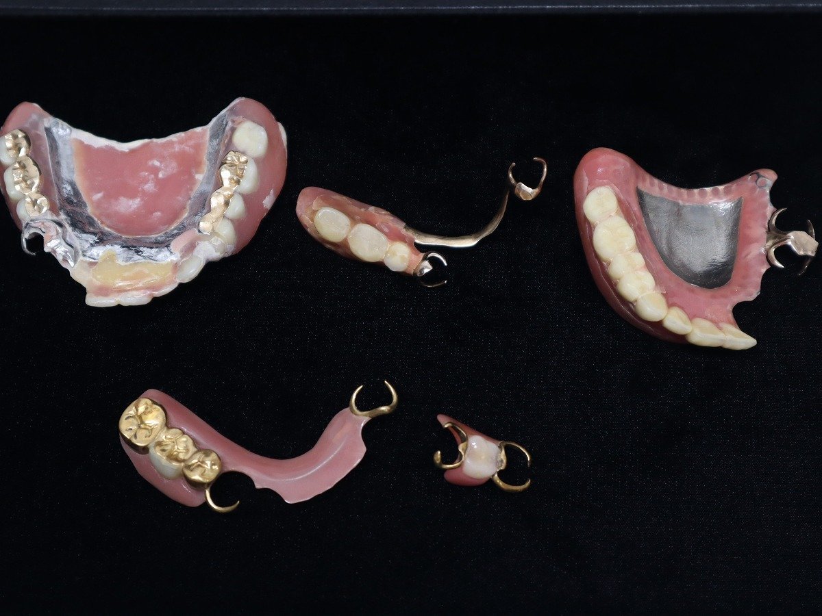 【1円スタート】入れ歯 総入れ歯 部分入れ歯 歯科材料 歯科技工 歯科金属 金 まとめ売り ジャンク 総重量約65.29g 7-A051/1/60P