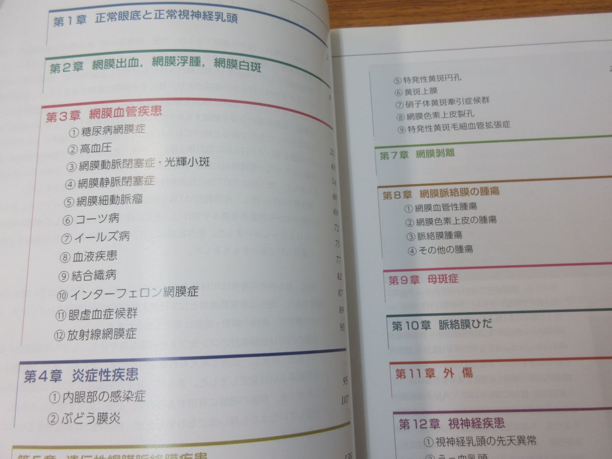 △01)カラーアトラス 眼底図譜 第6版/湯澤美都子/日本医事新報社/2015