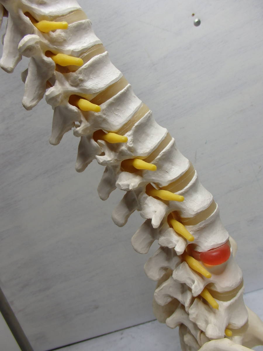 ◆人体模型◆骨格標本 脊椎 台付き 3B Scientific Gmbh サイエンティフィック 全長80cm_4