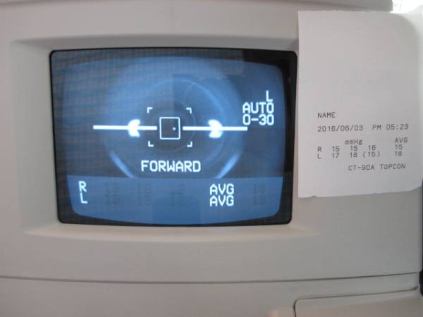 綺麗！トプコン　TOPCON　 CT-90A　眼科・検査　完動品②！