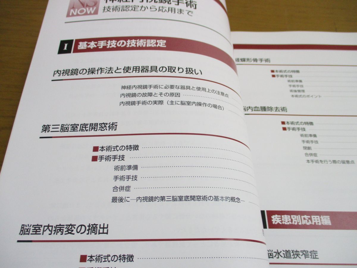 ○01)神経内視鏡手術/技術認定から応用まで/NS NOW No.2/寺本明