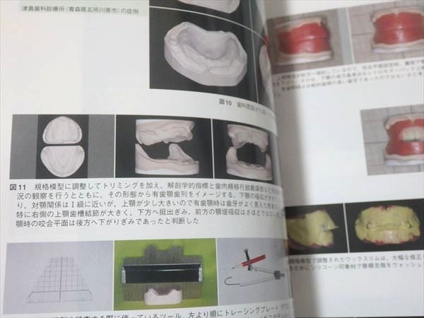 0 別冊 月刊歯科技工 目で見る人工歯排列＆歯肉形成 医歯薬出版 月刊「歯科技工」別冊 目でみる人工歯排列＆歯肉形成 実力アップのため 歯科技工／医歯薬出版株式会社 医 Yahoo!オークション - 歯科技工 歯科医師も！歯科技工士も！ デジタル歯科連携の バックナンバー／医歯薬出版株式会社