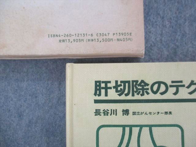 SN04-038 医学書院 肝切除のテクニックと患者管理 1985 長谷川博 S3D
