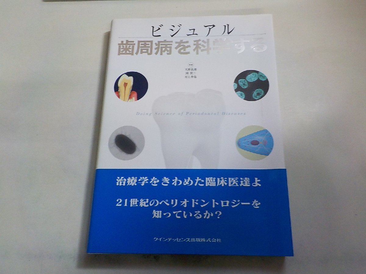 本 ビジュアル歯周病を科学する クインテッセンス出版株式会社