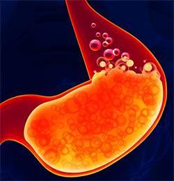 カーボメッドサプリメント　炭酸ガス 即決で送料込4000円!