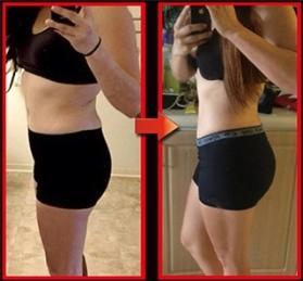 カーボメッドサプリメント　炭酸ガス 即決で送料込4000円!