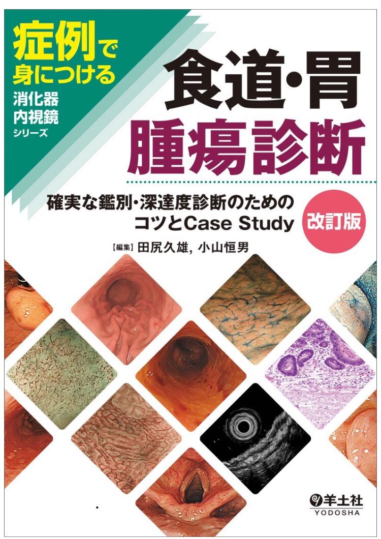 食道 胃 腫瘍診断 内科 研修 診断学 消化器内科
