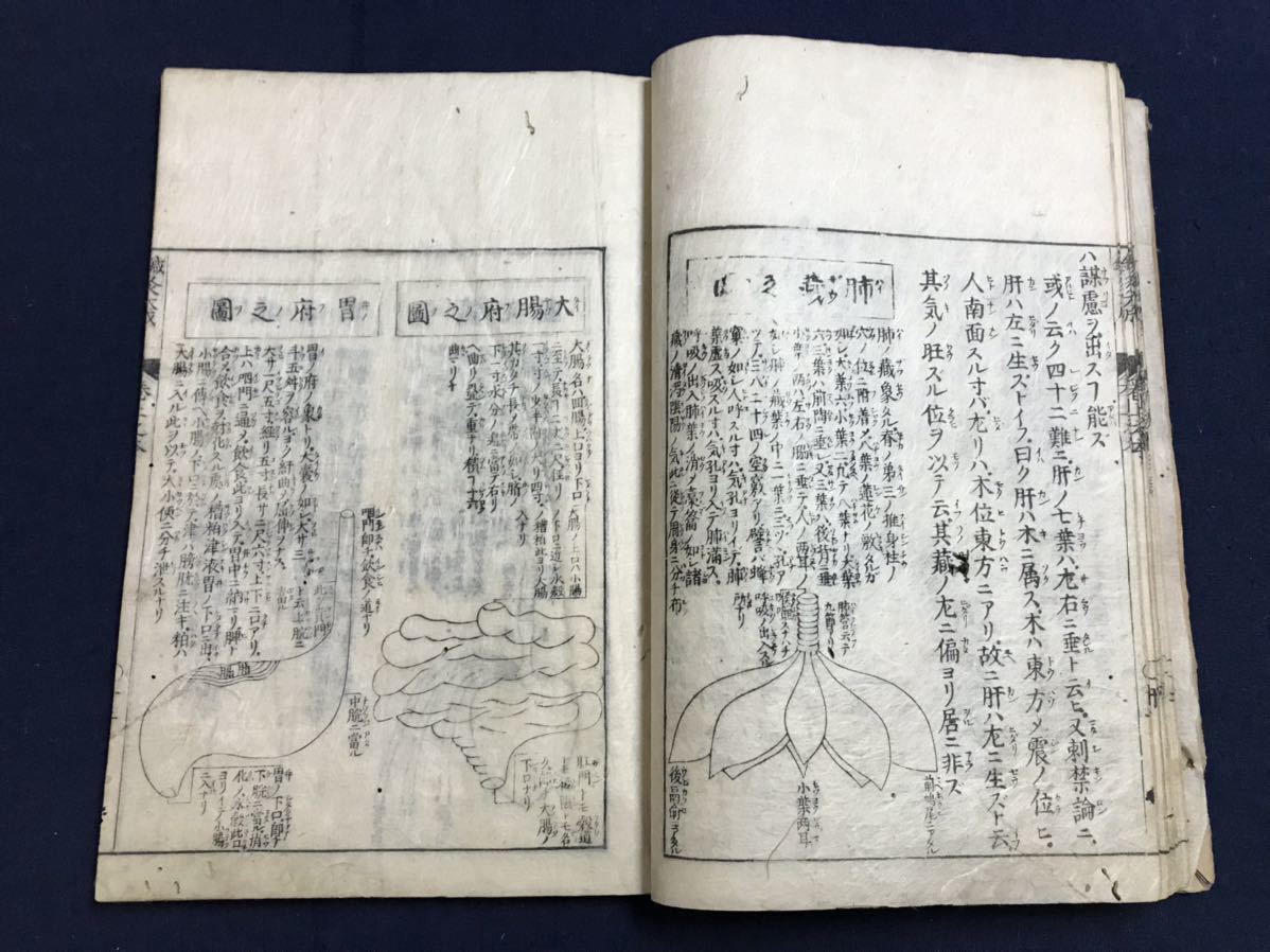 鍼灸抜萃大成 6冊 絵入り 検 中国唐本漢籍和本和書お経写経写本古典古
