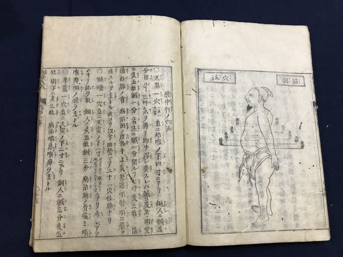 鍼灸抜萃大成 6冊 絵入り 検 中国唐本漢籍和本和書お経写経写本古典古