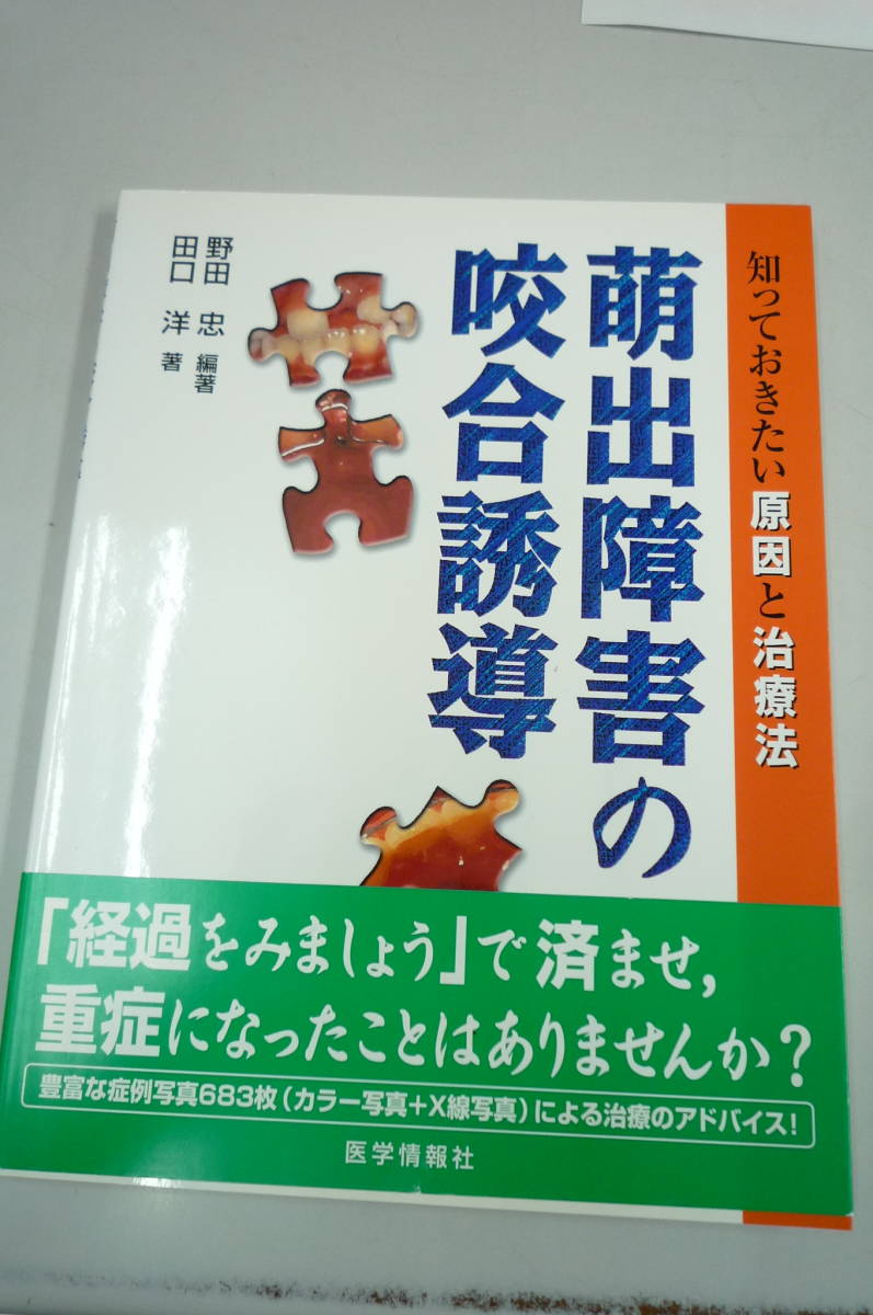 萌出障害の咬合誘導 知っておきたい原因と治療法 野田忠 田口洋 医学